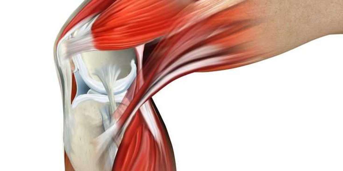 Understanding and Treating Muscle Pain Behind the Knee and Thigh