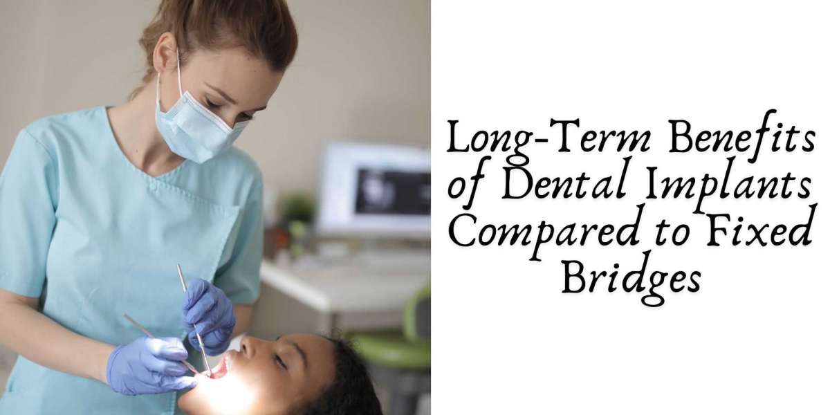 Long-Term Benefits of Dental Implants Compared to Fixed Bridges