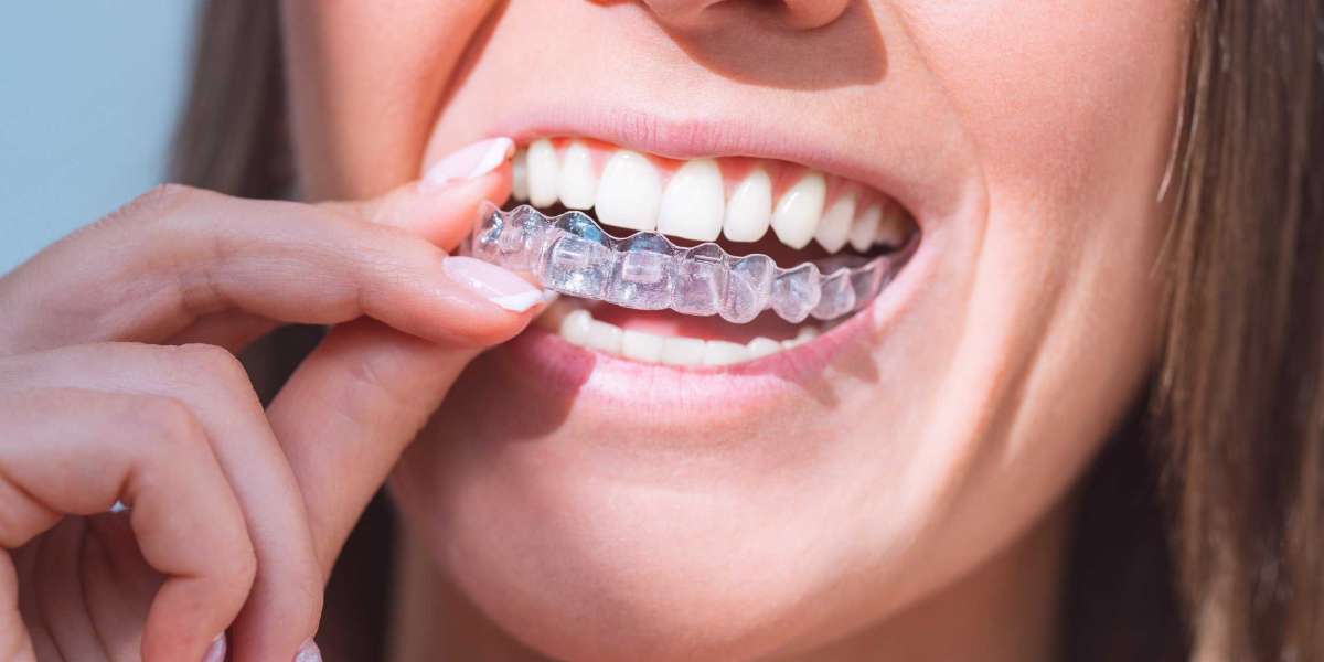 Dental Implants in Hatfield vs. Invisalign in Waltham Cross