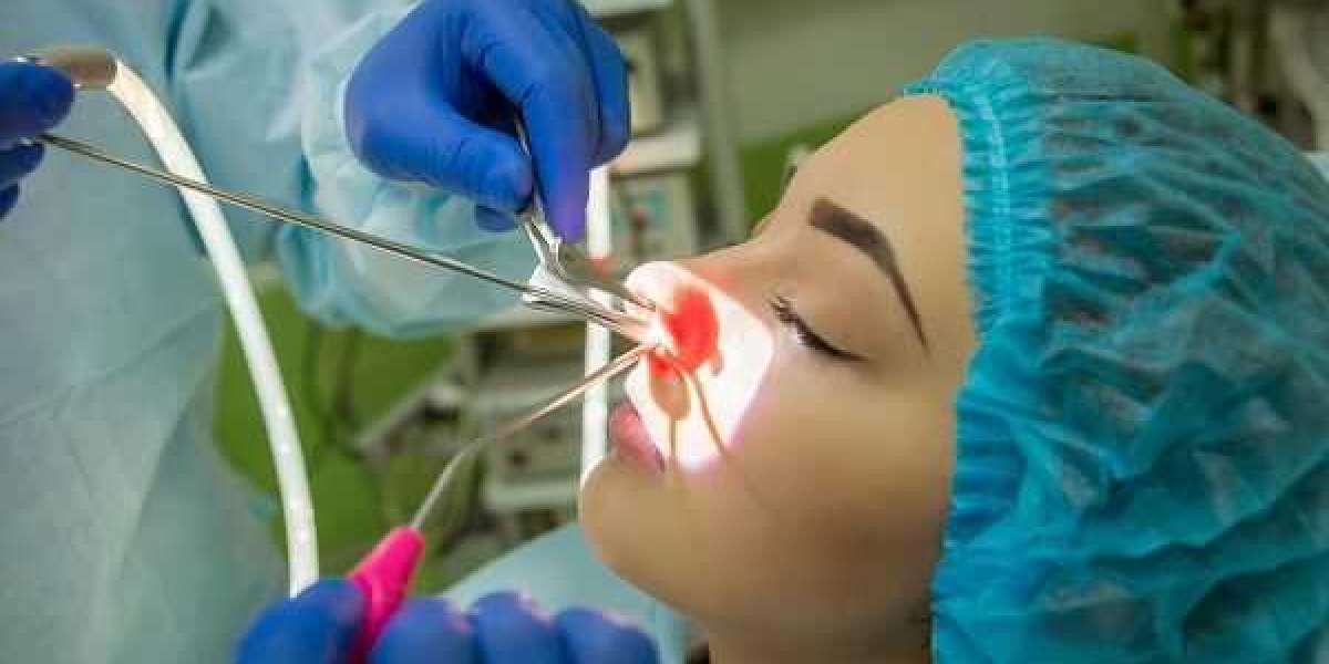 Sinus Dilation Devices Market Segmentation, Development Factors, Report 2024-2032