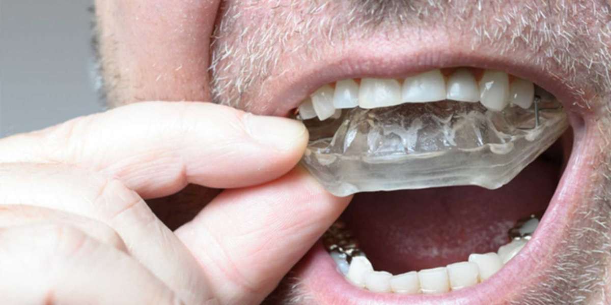 From Anxiety to Alignment: Exploring the Causes of Teeth Grinding